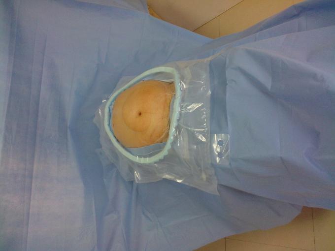 c section gown