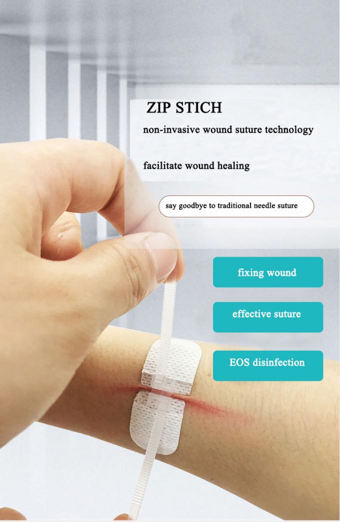 Non Invasive Zip Stitch Suture Wound Closure Device Skin Closure Non