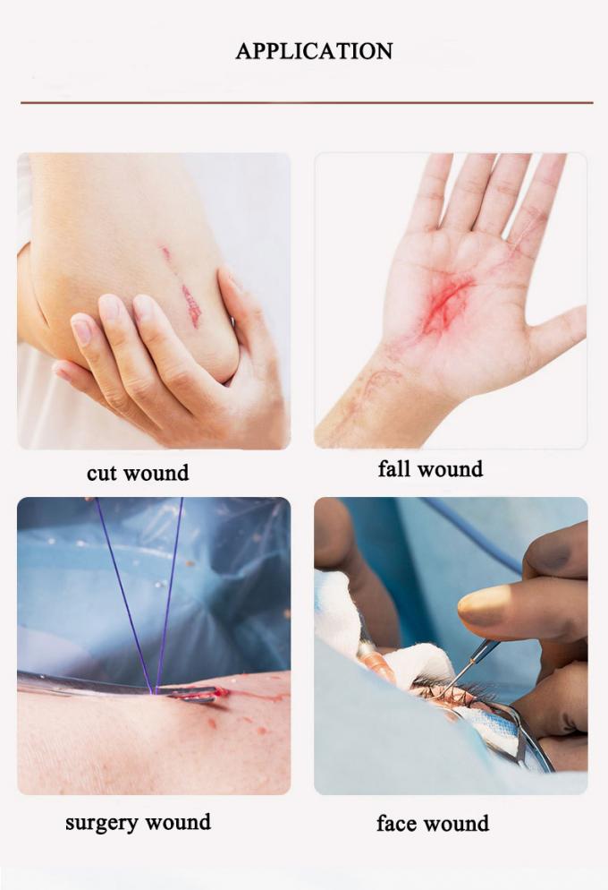 Non Invasive Zip Stitch Suture Wound Closure Device Skin Closure Non