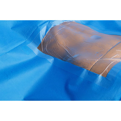 Sterile Surgical C-Section Pack Set Cesarean Section Surgical Pack Caesarean Drape Set